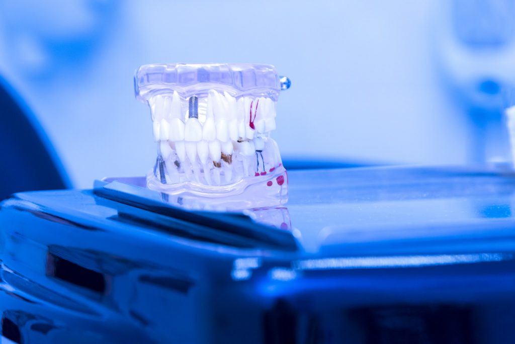 Tooth model in dental office